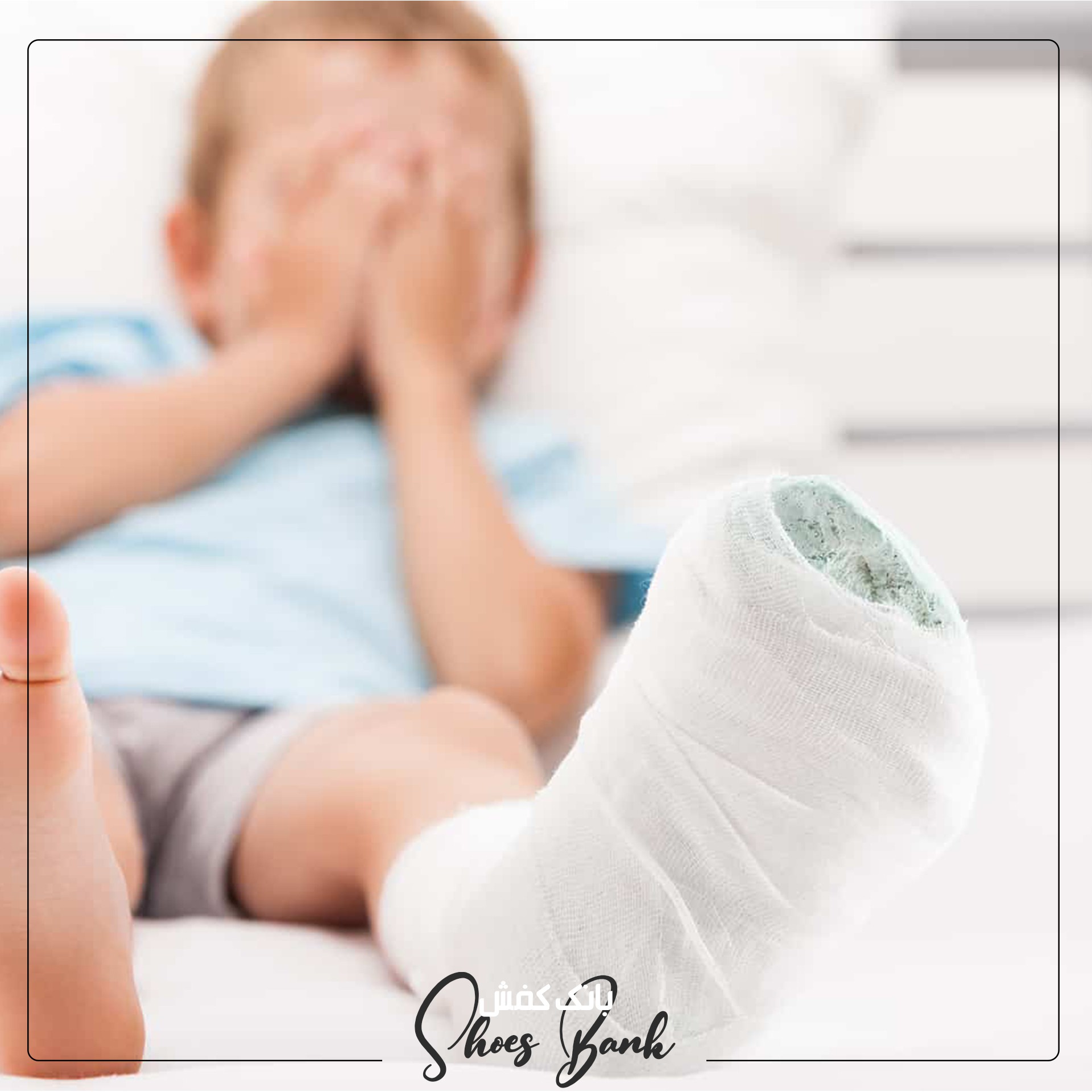 یکی از راههای درمان سندرم سیور در درجات شدید آن ،گچ گرفتن پای بیمار است.